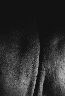 <em>1. Platz Publikumspreis des Wettbewerbs «Im Wandel» des Fotofestivals Lenzburg:</em> «Rücken» von Jennifer Loosli (Reinach). Foto: Jennifer Loosli/zvg ffl